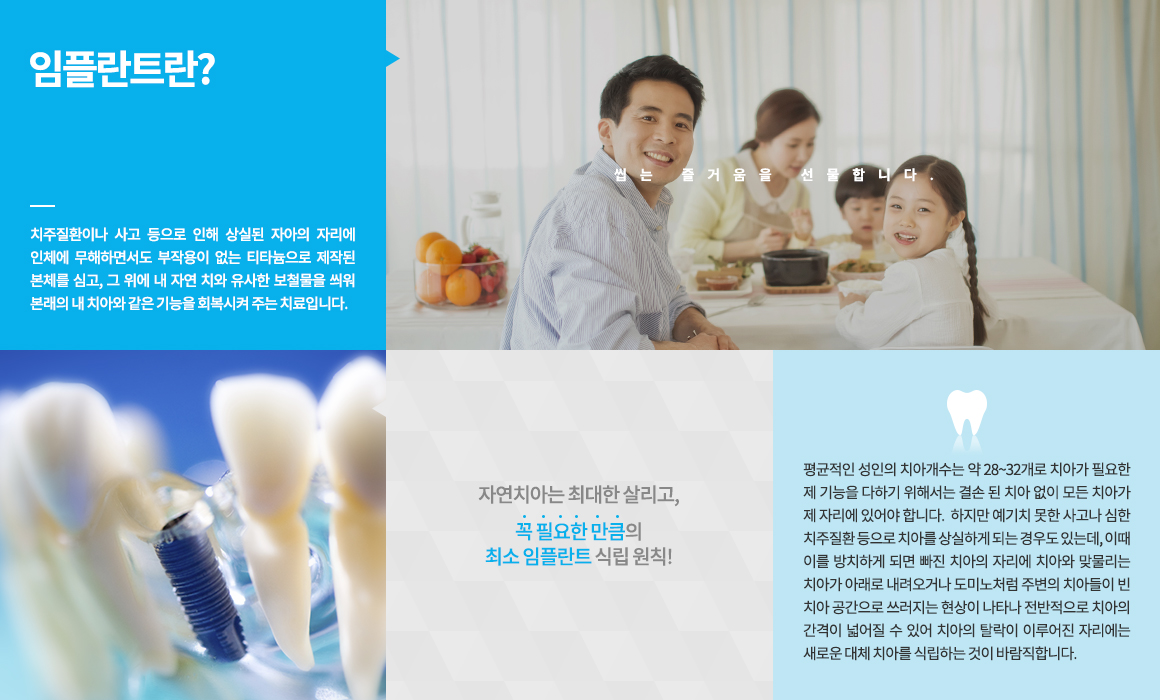 평균적인 성인의 치아개수는 약 28~32개로 치아가 필요한 제 기능을 다하기 위해서는 결손 된 치아 없이 모든 치아가 제 자리에 있어야 합니다. 하지만 예기치 못한 사고나 심한 치주질환 등으로 치아를 상실하게 되는 경우도 있는데, 이때 이를 방치하게 되면 빠진 치아의 자리에 치아와 맞물리는 치아가 아래로 내려오거나 도미노처럼 주변의 치아들이 빈 치아 공간으로 쓰러지는 현상이 나타나 전반적으로 치아의 간격이 넓어질 수 있어 치아의 탈락이 이루어진 자리에는 새로운 대체 치아를 식립하는 것이 바람직합니다. 
씹는 즐거움 선물!! 치주질환이나 사고 등으로 인해 상실된 자아의 자리에 인체에 무해하면서도 부작용이 없는 티타늄으로 제작된 본체를 심고, 그 위에 내 자연 치와 유사한 보철물을 씌워 본래의 내 치아와 같은 기능을 회복시켜 주는 치료입니다. 자연치아는 최대한 살리고, 꼭 필요한 만큼의 최소 임플란트 식립 원칙!